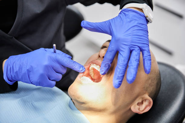 Best Emergency Denture Repair in Reform, AL